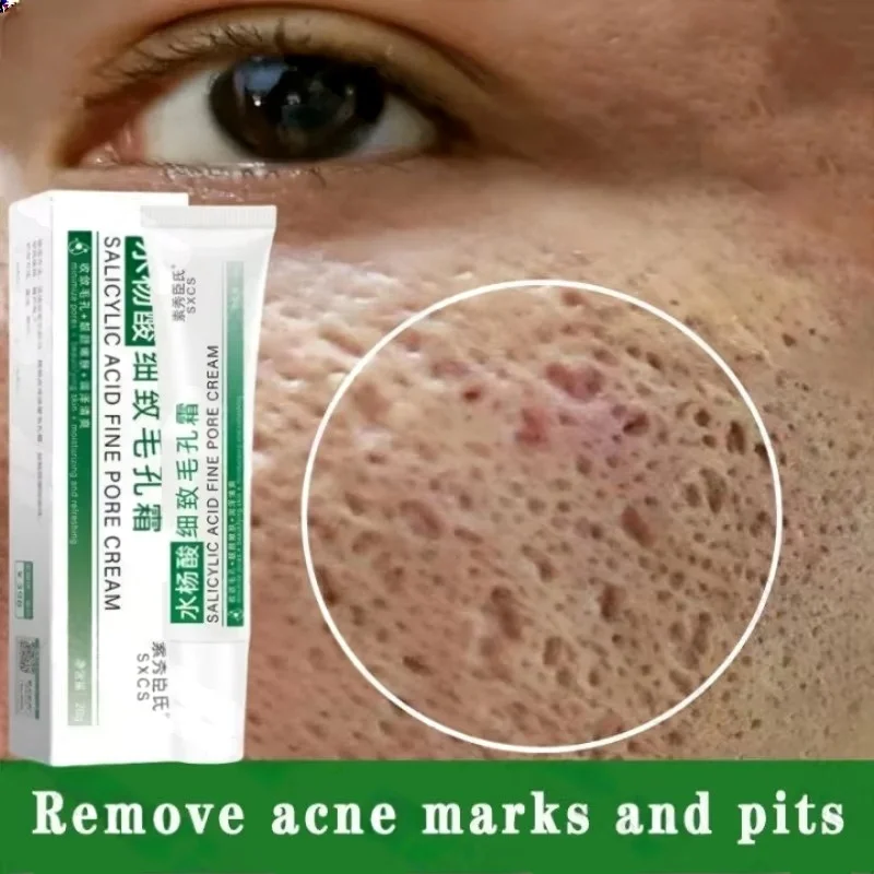 Azelaic Acid Cream - Krem z kwasem salicylowym do oczyszczania